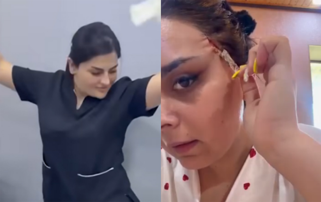 “Dr. Gülü” daha bir pasiyenti yarıcan qoyub? - VİDEO