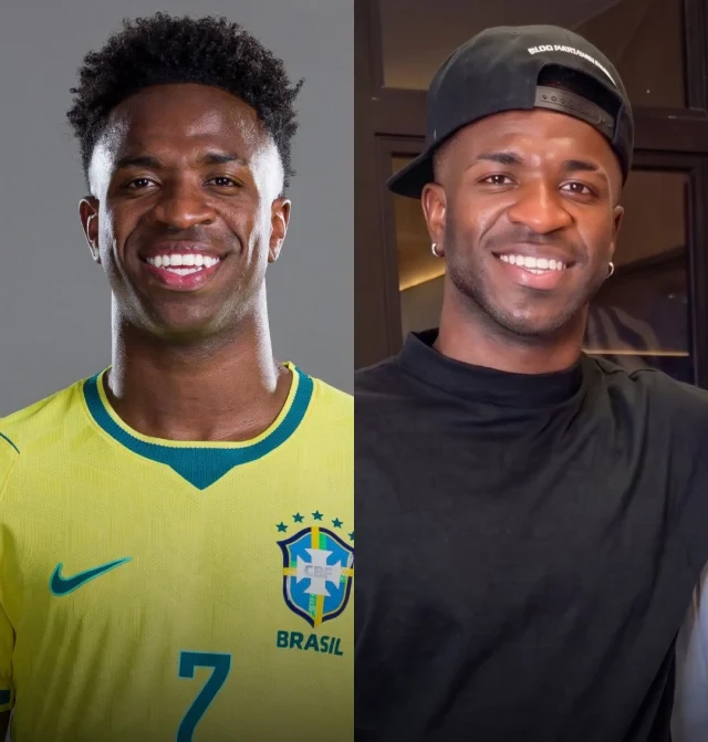 Braziliyalı məşhur futbolçu estetik əməliyyata girdi, belə oldu – FOTO&nbsp;&nbsp;