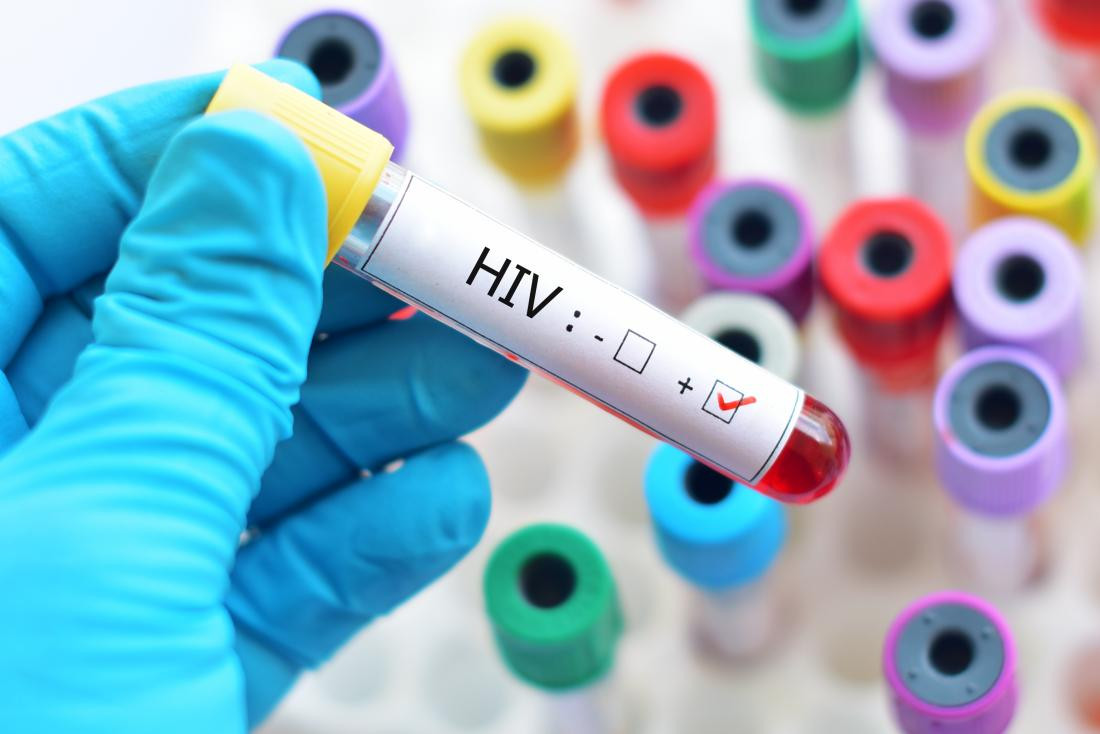 &nbsp; &nbsp; İİV epidemiyasına qarşı cavab tədbirləri necə keçirilir?