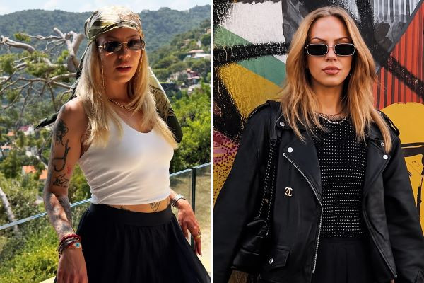 27 yaşlı bloger öldü - Plastik əməliyyatdan sonra