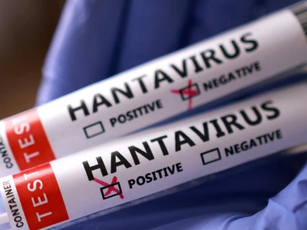 Hantavirus: siçanlardan yayılan viruslar - Dünya yeni təhlükəni rahat qarşılayır